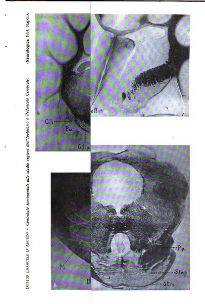 Neurologica rivista italiana di neuropatologia e psichiatria