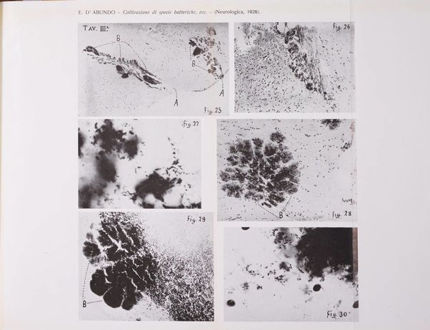 Neurologica rivista italiana di neuropatologia e psichiatria