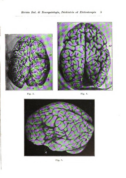 Rivista italiana di neuropatologia, psichiatria ed elettroterapia