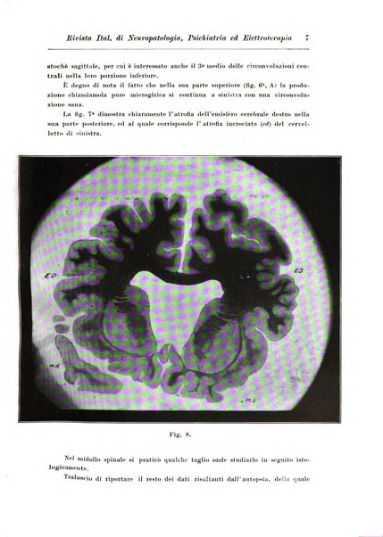 Rivista italiana di neuropatologia, psichiatria ed elettroterapia