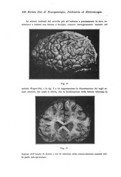 Rivista italiana di neuropatologia, psichiatria ed elettroterapia