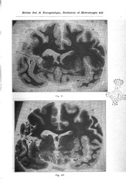 Rivista italiana di neuropatologia, psichiatria ed elettroterapia