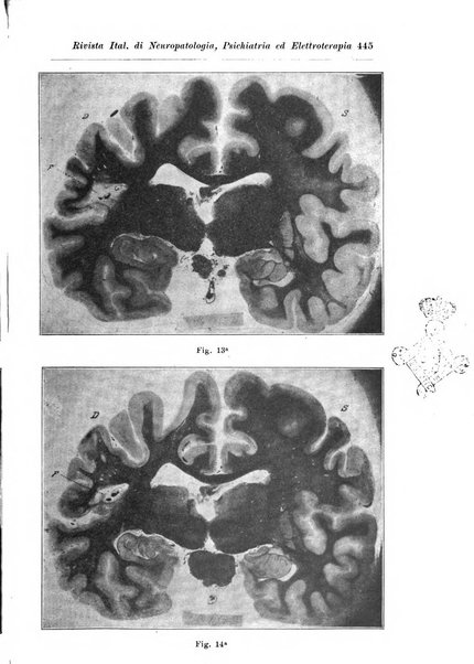 Rivista italiana di neuropatologia, psichiatria ed elettroterapia