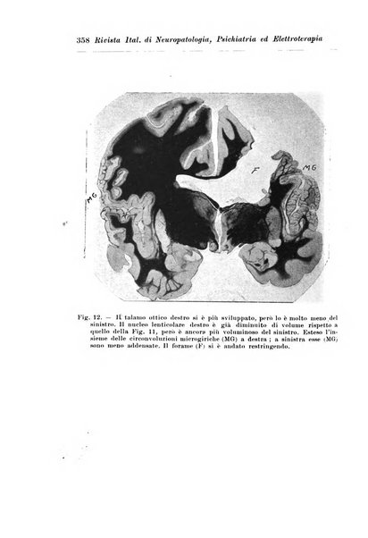 Rivista italiana di neuropatologia, psichiatria ed elettroterapia