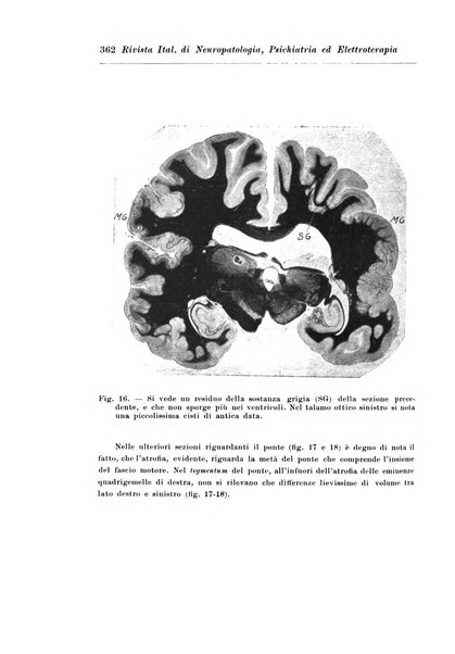 Rivista italiana di neuropatologia, psichiatria ed elettroterapia