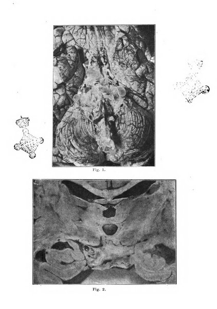 Rivista italiana di neuropatologia, psichiatria ed elettroterapia