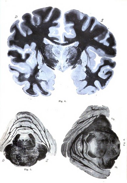 Rivista italiana di neuropatologia, psichiatria ed elettroterapia