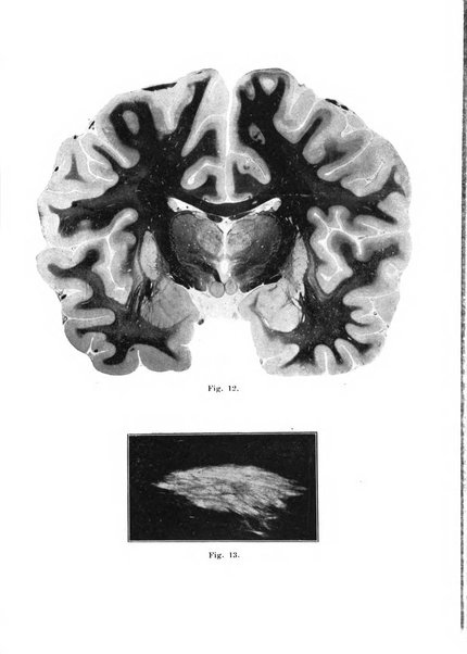 Rivista italiana di neuropatologia, psichiatria ed elettroterapia