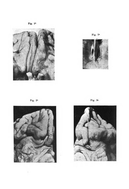 Rivista italiana di neuropatologia, psichiatria ed elettroterapia