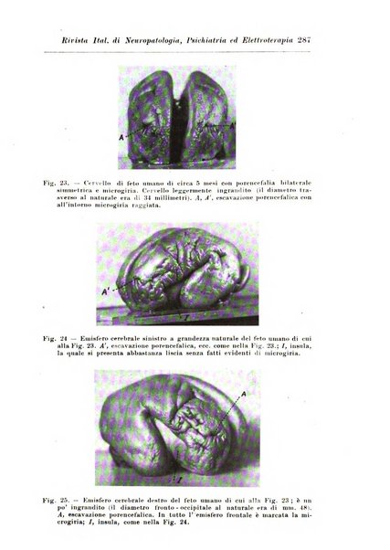 Rivista italiana di neuropatologia, psichiatria ed elettroterapia