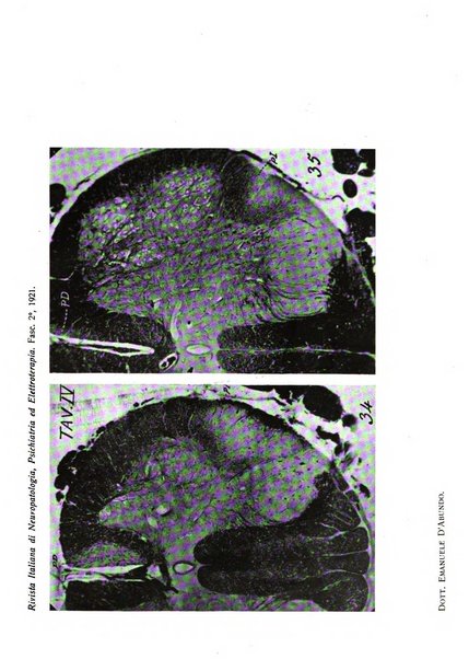 Rivista italiana di neuropatologia, psichiatria ed elettroterapia