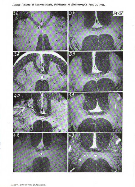 Rivista italiana di neuropatologia, psichiatria ed elettroterapia