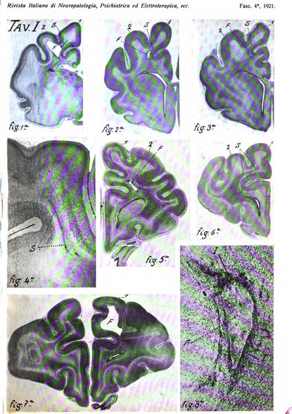 Rivista italiana di neuropatologia, psichiatria ed elettroterapia