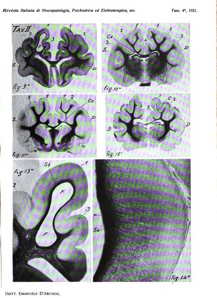 Rivista italiana di neuropatologia, psichiatria ed elettroterapia