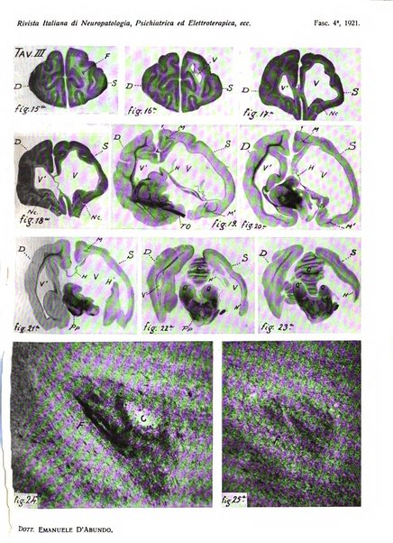 Rivista italiana di neuropatologia, psichiatria ed elettroterapia