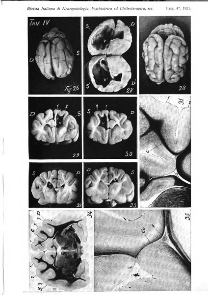 Rivista italiana di neuropatologia, psichiatria ed elettroterapia