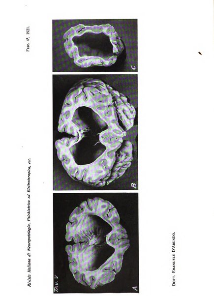 Rivista italiana di neuropatologia, psichiatria ed elettroterapia