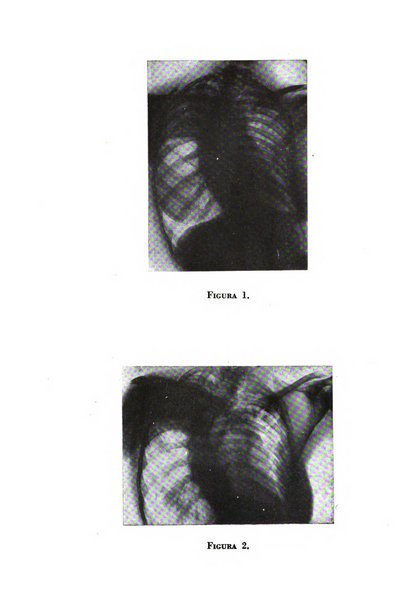 Rivista di patologia dell'apparato respiratorio