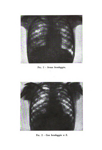 Rivista di patologia dell'apparato respiratorio