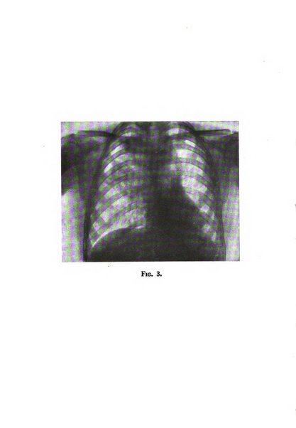 Rivista di patologia dell'apparato respiratorio