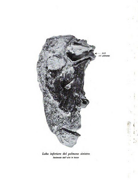 Rivista di patologia dell'apparato respiratorio