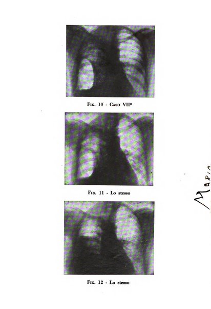 Rivista di patologia dell'apparato respiratorio