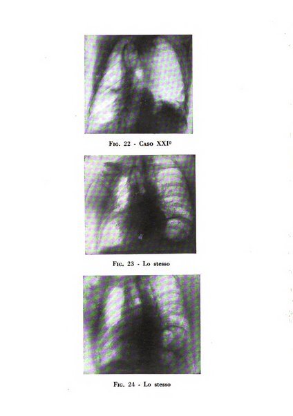 Rivista di patologia dell'apparato respiratorio