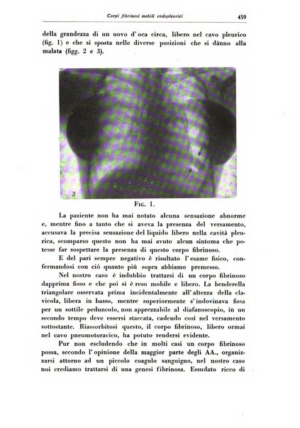 Rivista di patologia dell'apparato respiratorio