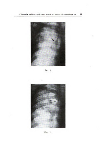 Rivista di patologia dell'apparato respiratorio