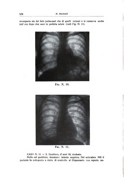 Rivista di patologia dell'apparato respiratorio