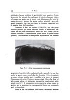 giornale/CFI0721266/1935/unico/00000164