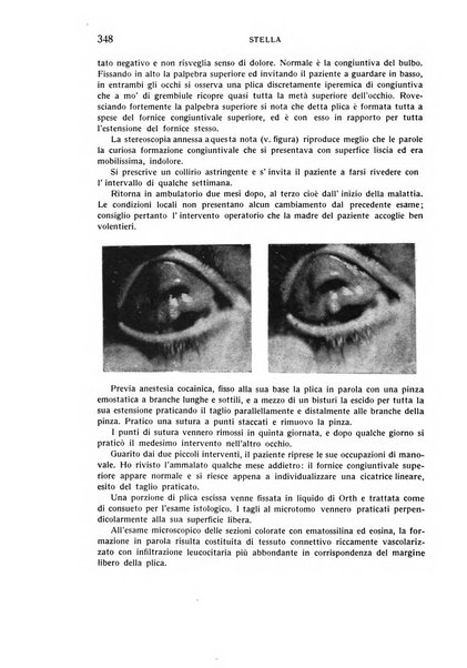 Bollettino d'oculistica periodico d'oculistica pratica