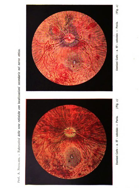 Bollettino d'oculistica periodico d'oculistica pratica