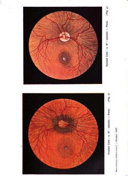 Bollettino d'oculistica periodico d'oculistica pratica