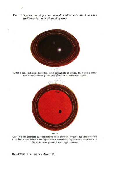 Bollettino d'oculistica periodico d'oculistica pratica