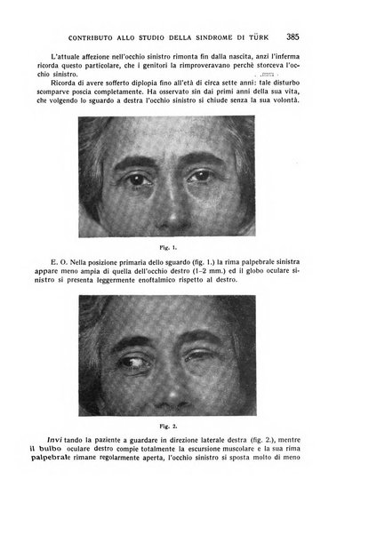 Bollettino d'oculistica periodico d'oculistica pratica