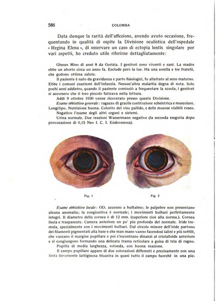 Bollettino d'oculistica periodico d'oculistica pratica