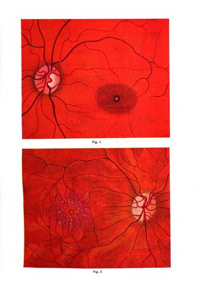 Bollettino d'oculistica periodico d'oculistica pratica