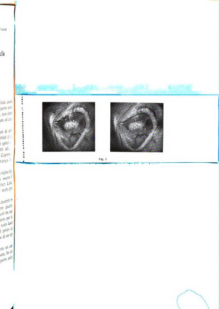 Bollettino d'oculistica periodico d'oculistica pratica