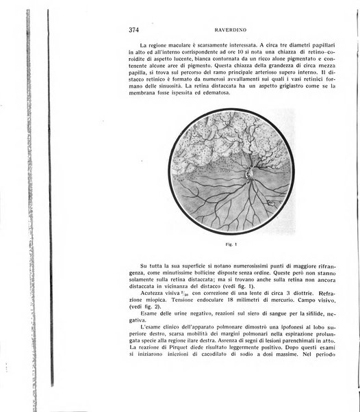 Bollettino d'oculistica periodico d'oculistica pratica