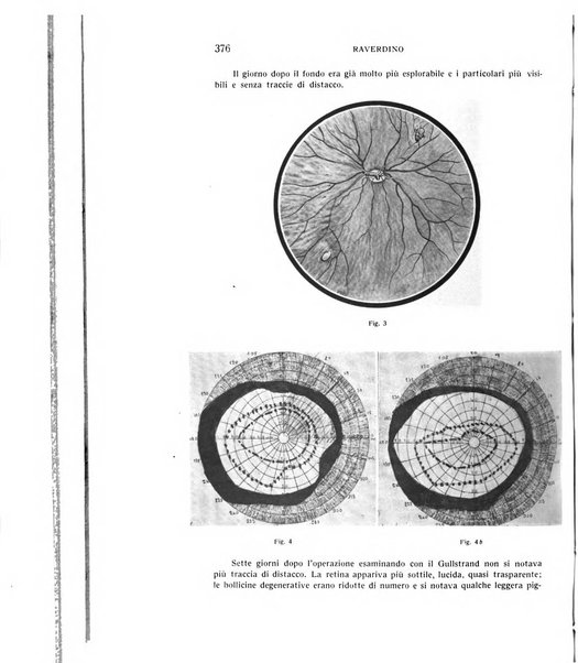 Bollettino d'oculistica periodico d'oculistica pratica