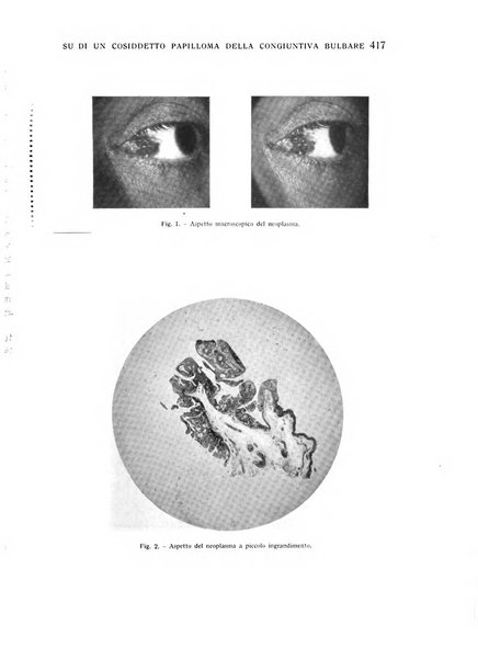 Bollettino d'oculistica periodico d'oculistica pratica