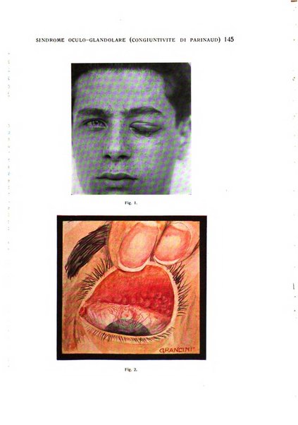 Bollettino d'oculistica periodico d'oculistica pratica