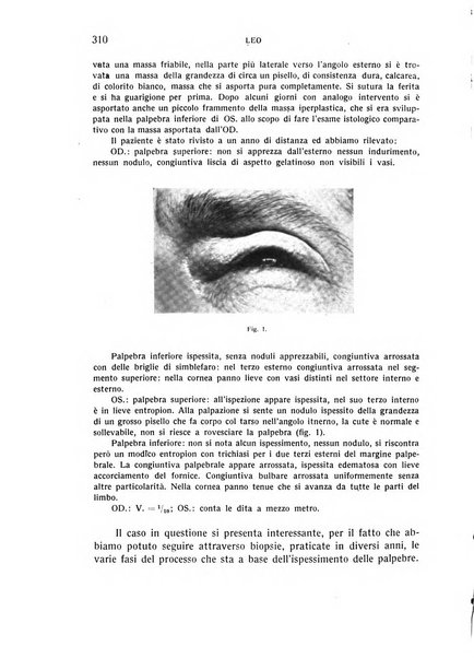 Bollettino d'oculistica periodico d'oculistica pratica