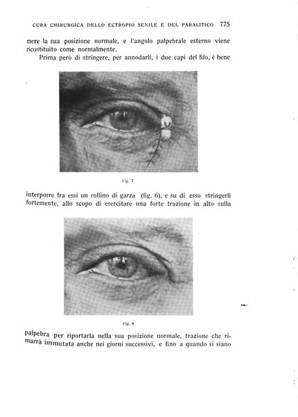 Bollettino d'oculistica periodico d'oculistica pratica