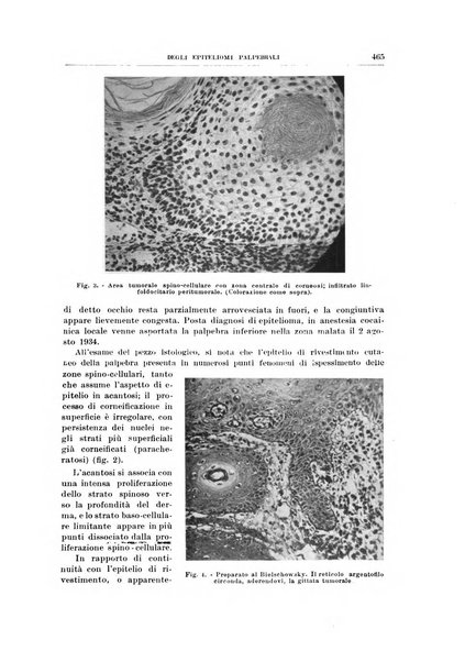 Bollettino d'oculistica periodico d'oculistica pratica