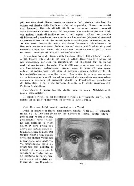 Bollettino d'oculistica periodico d'oculistica pratica