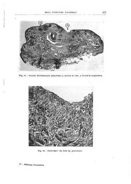 Bollettino d'oculistica periodico d'oculistica pratica