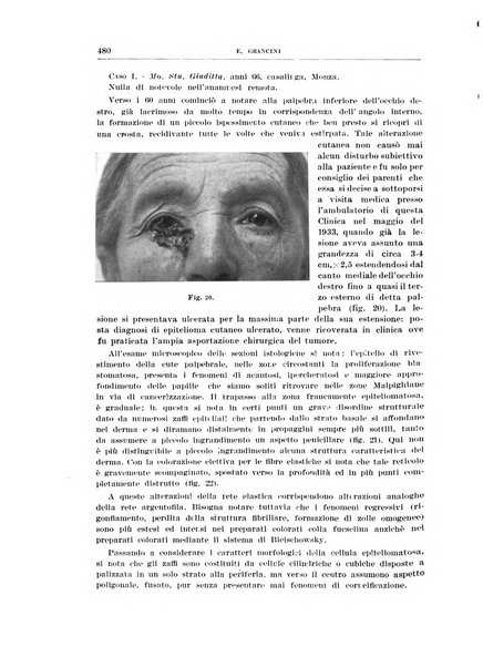 Bollettino d'oculistica periodico d'oculistica pratica