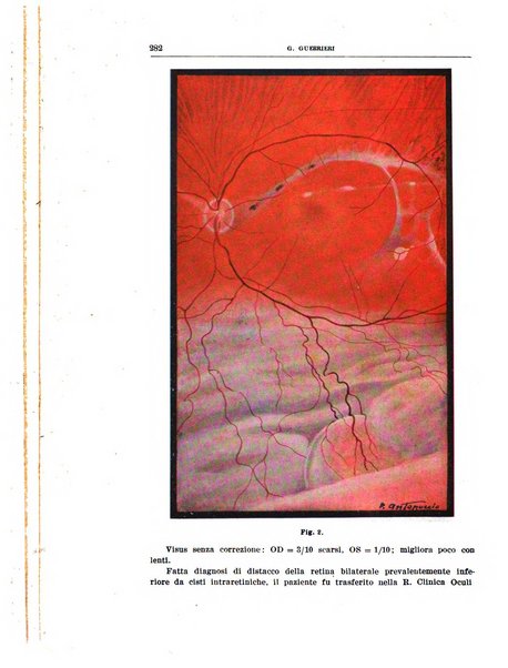 Bollettino d'oculistica periodico d'oculistica pratica